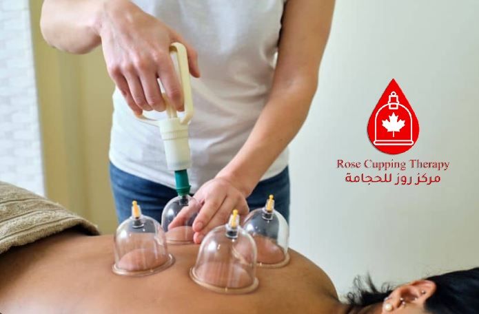 GTA Cupping Therapy