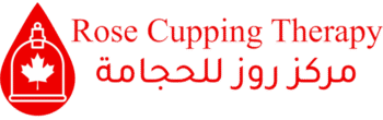 cupping therapy