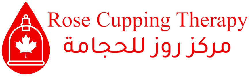 cupping therapy