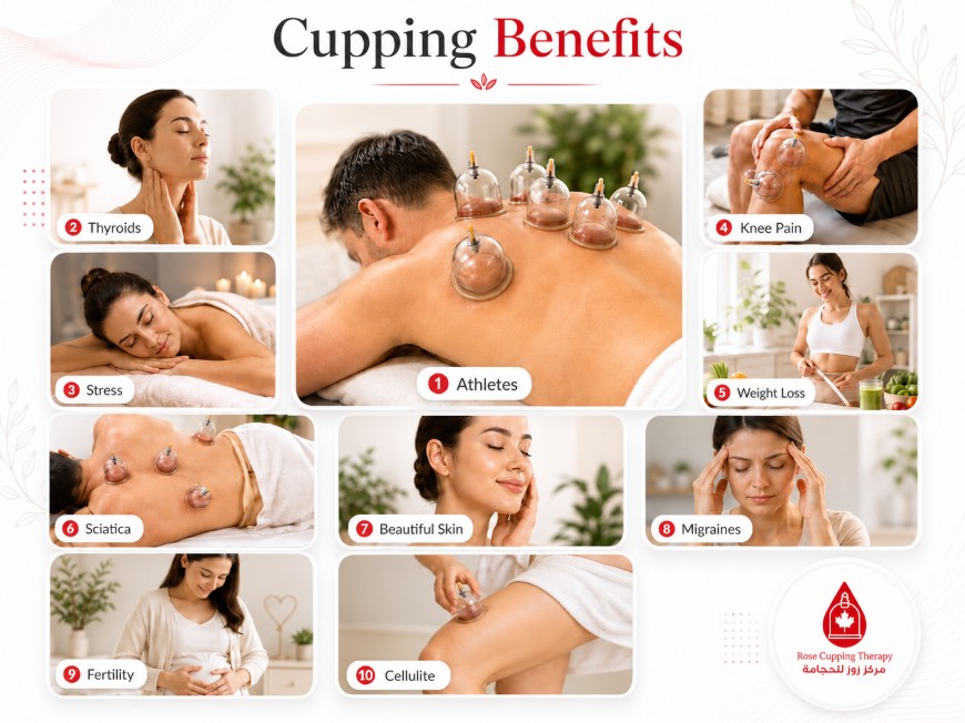 Cupping Therapy