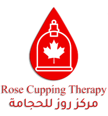 Rose Cupping Therapy