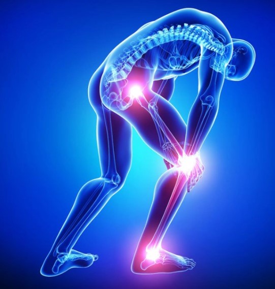 Cupping For Sciatica Rose Cupping Therapy