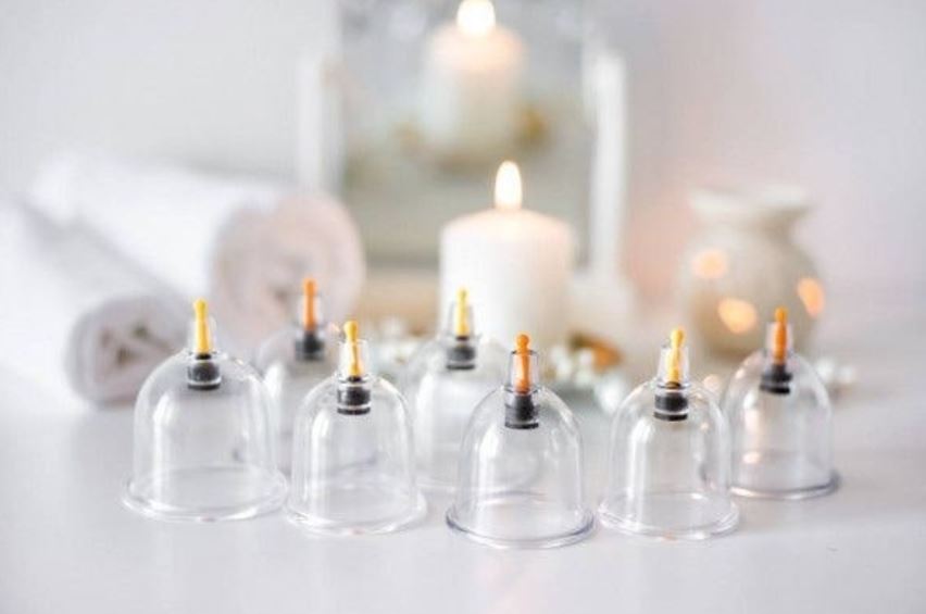 Windsor Cupping Therapy